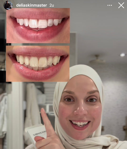 delia skin love2smile whitening – tweede afbeelding