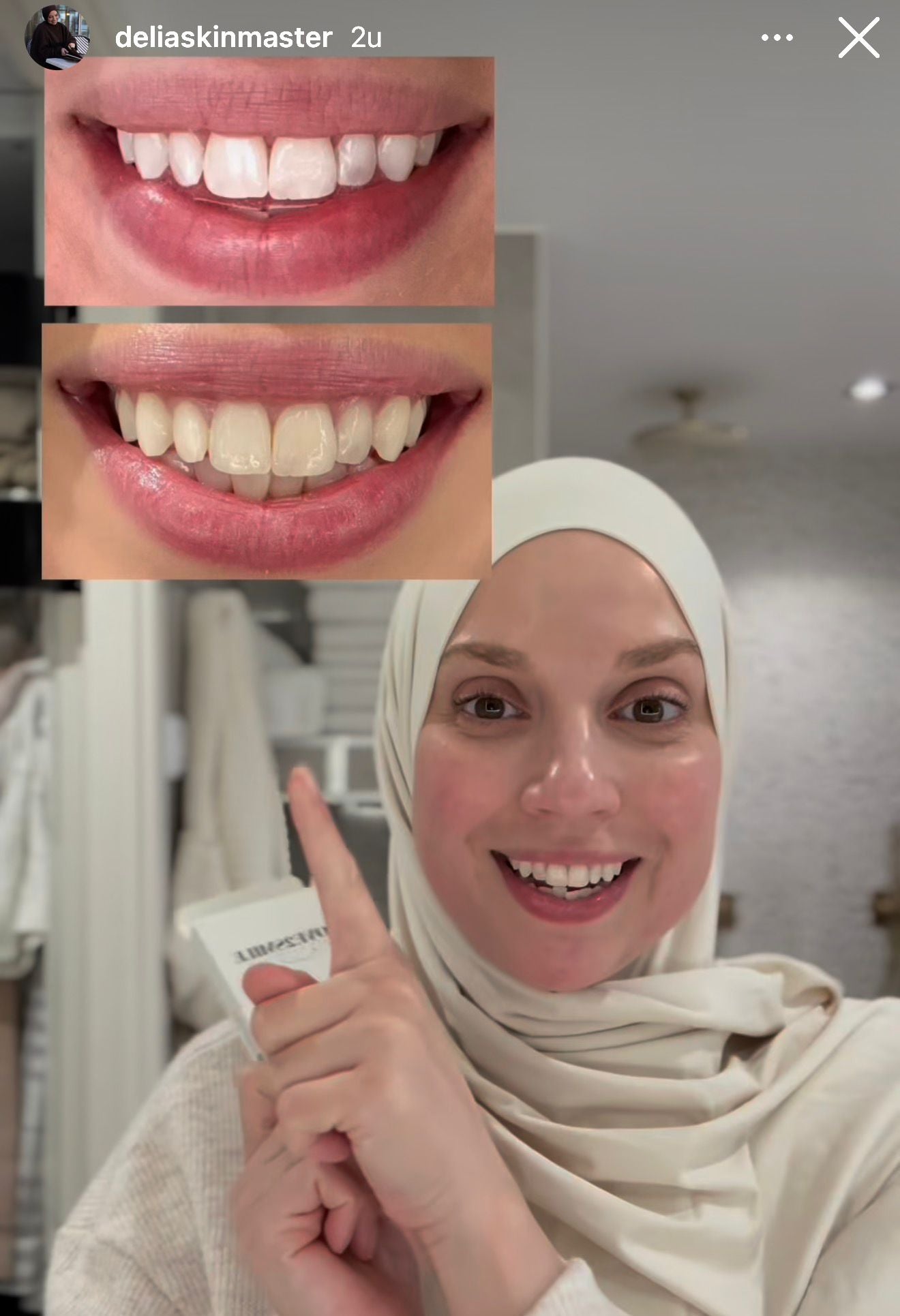 delia skin love2smile whitening