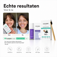 tandenbleken amsterdam